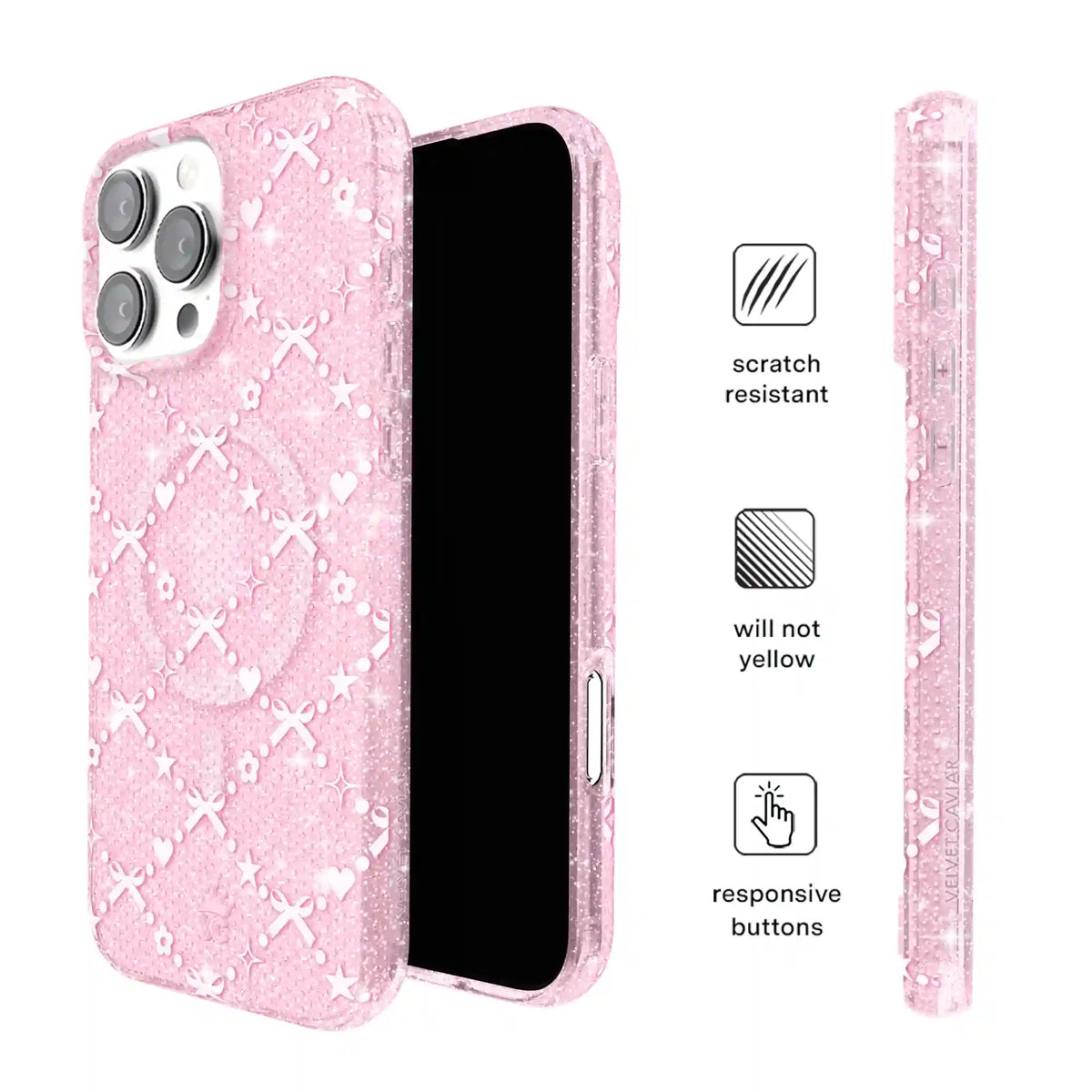Sugar Baby Glitter iPhone Case