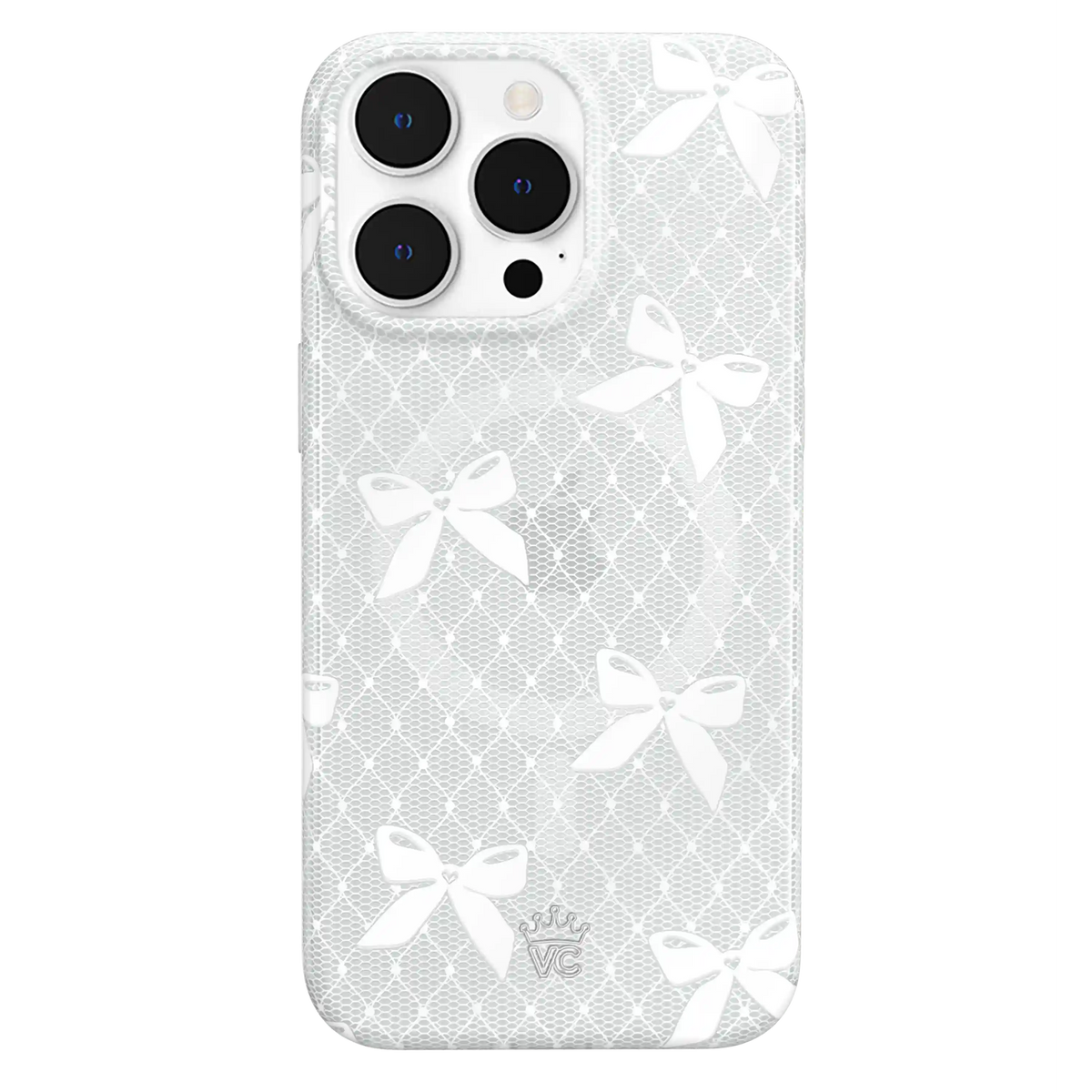 Vintage Lace Bows iPhone Case
