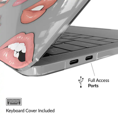 Nude Lips MacBook Case